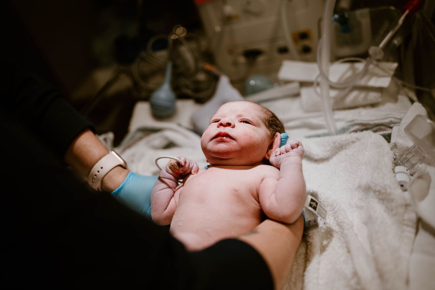 A newborn baby lies on hospital bedding wearing identification bracelets shortly after birth.