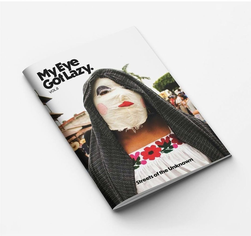 Publicación en revista My eye got lazy