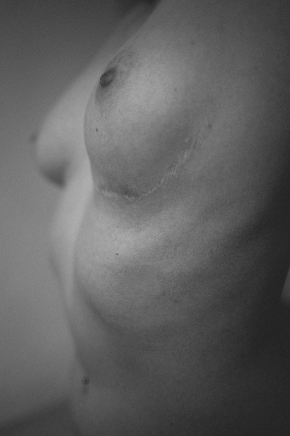 Black and white artistic photograph of human torso in soft focus showing skin texture and contours.