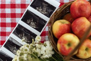 Ultrasound photos beside a basket of fresh red apples on a red and white checkered tablecloth with white flowers.