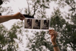 Two hands hold up a strip of black and white ultrasound photos against a backdrop of green trees outdoors.
