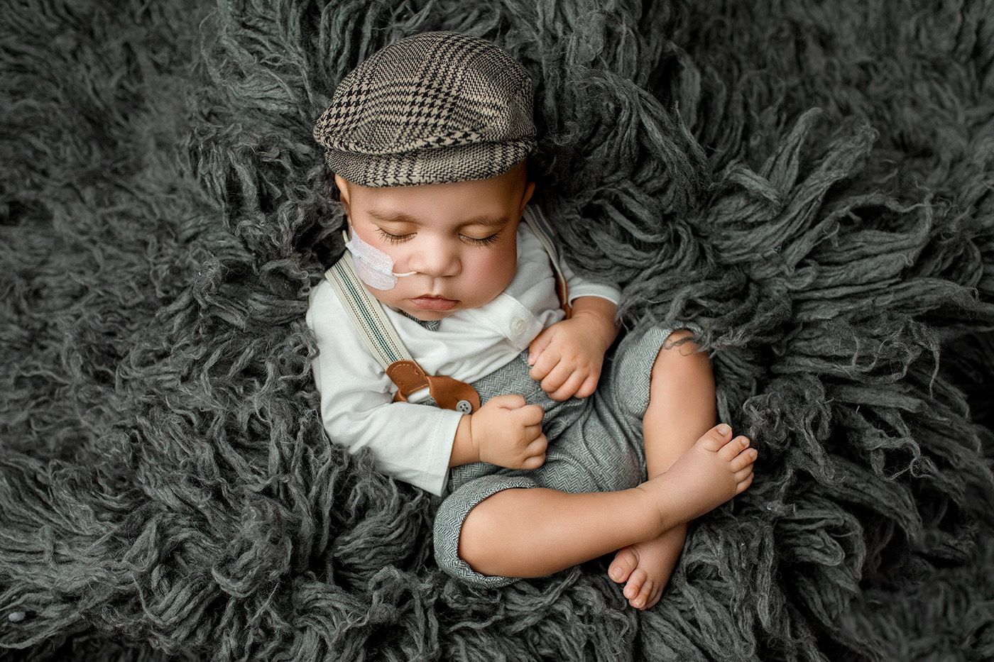 baby with muscular dystrophy, posed for newborn photography, cute, vintage outfit, inclusion, best newborn photographer, safe posing.