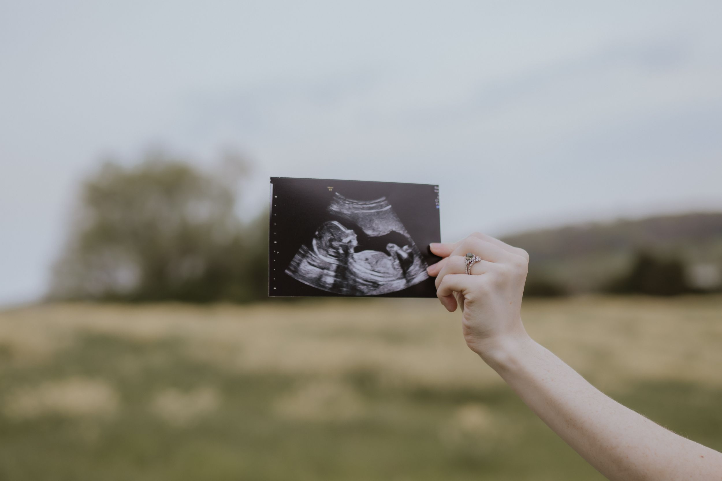 Knoxville Maternity Photographer. Roane County. Tennessee Photographer. Tennessee Maternity photography. Fine Art. Maternity Packages