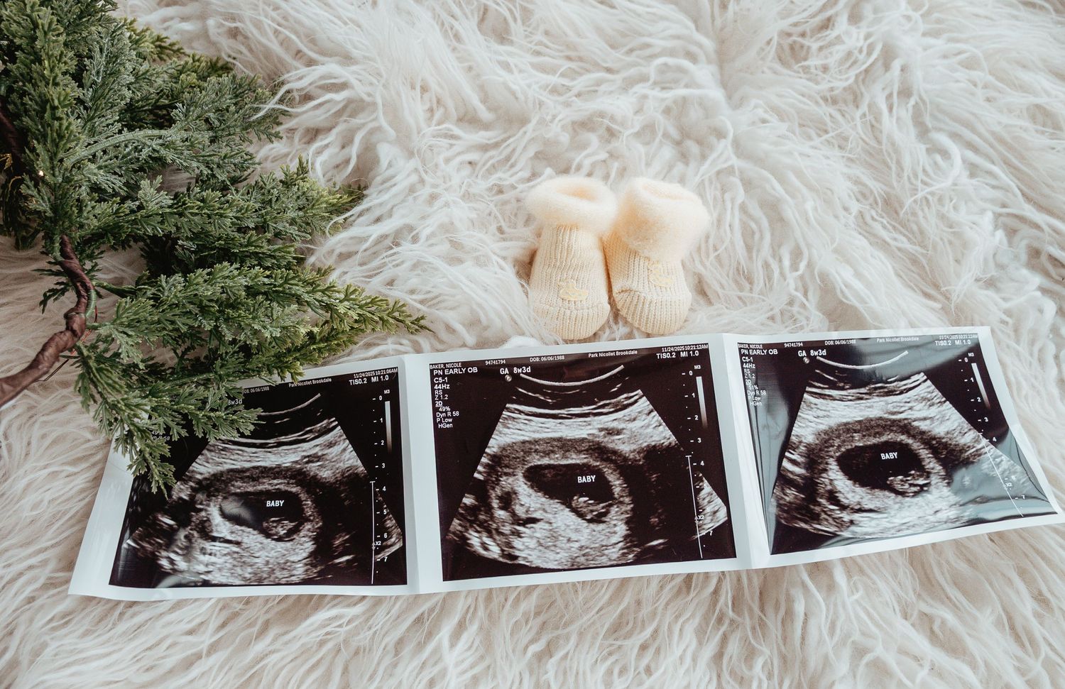 Three ultrasound sonogram photos displayed on white fur with baby booties and evergreen branches as decor.