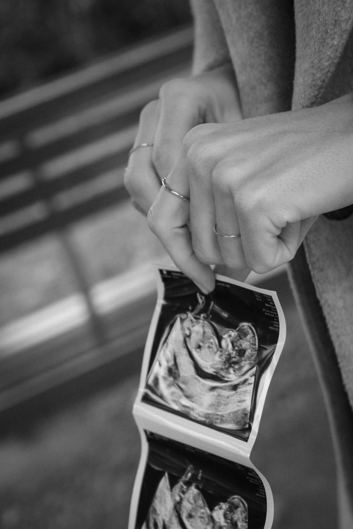 Hands holding ultrasound scan photos showing prenatal development images.