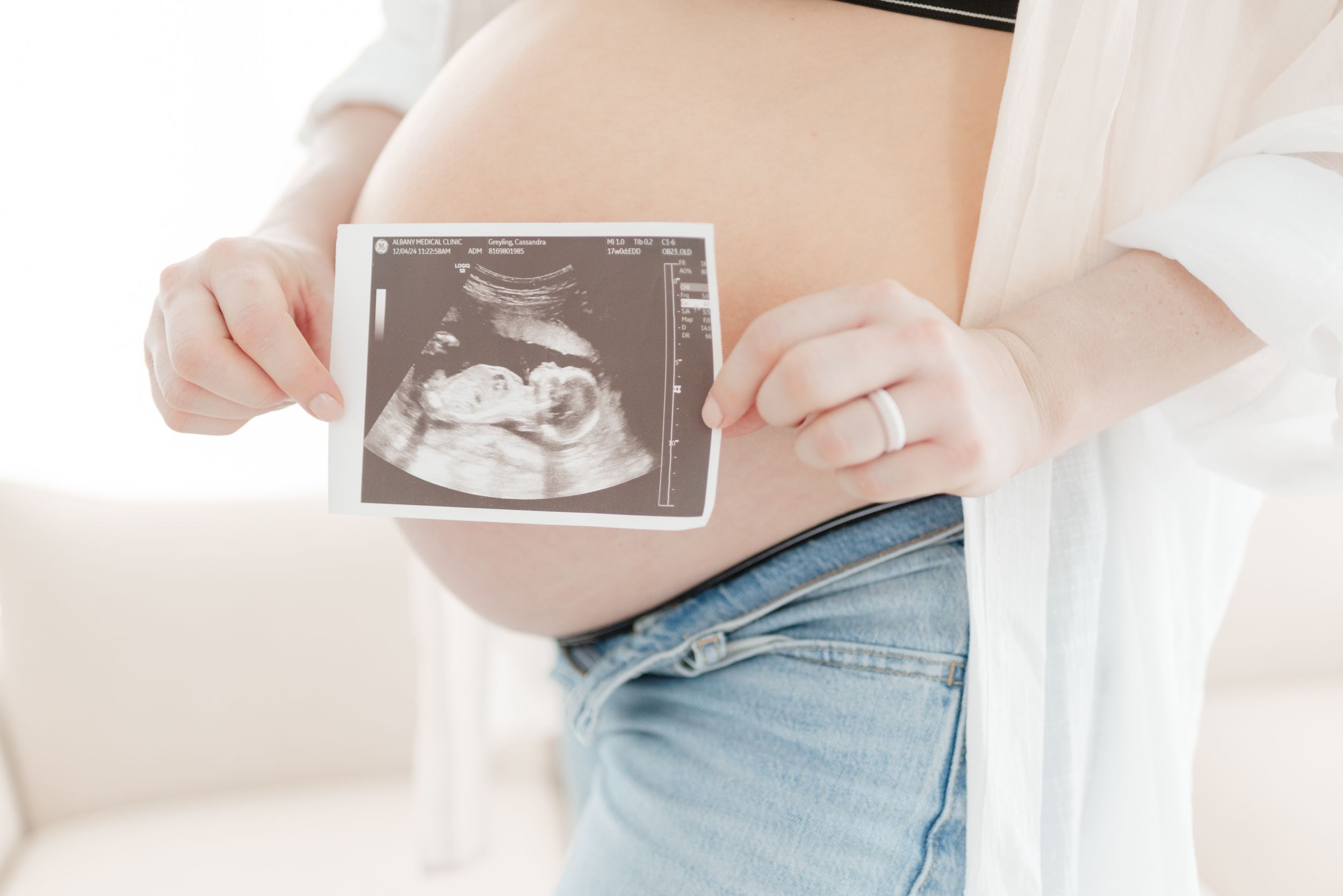 Toronto Mom holding ultrasound for maternity photoshoot at Mint Room Studio by Jess GC Photography