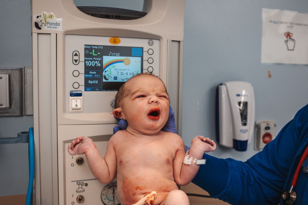 Newborn baby yawning during a medical checkup with monitoring equipment visible in the background.
