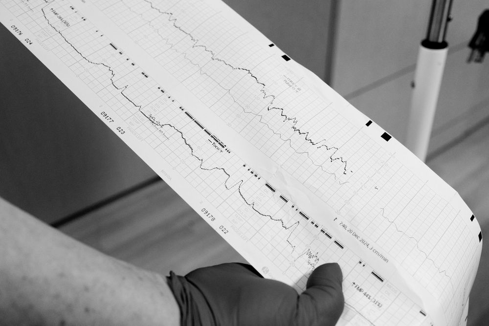 Medical chart showing vital sign readings and patient data on paper.