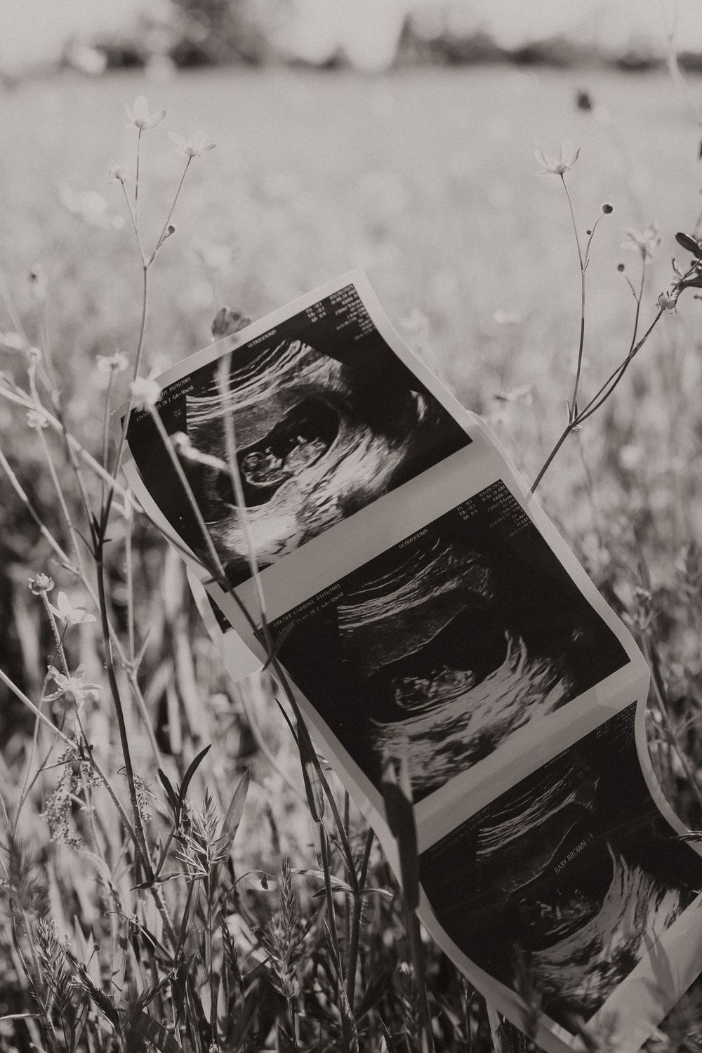 A series of ultrasound photos displayed among wildflowers in a black and white artistic composition.