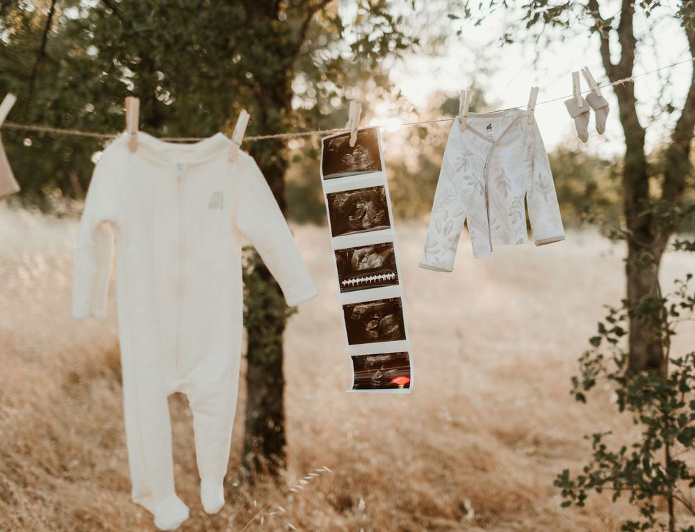 Baby clothes and ultrasound photos hang from twine in a rustic outdoor setting creating a pregnancy announcement display.