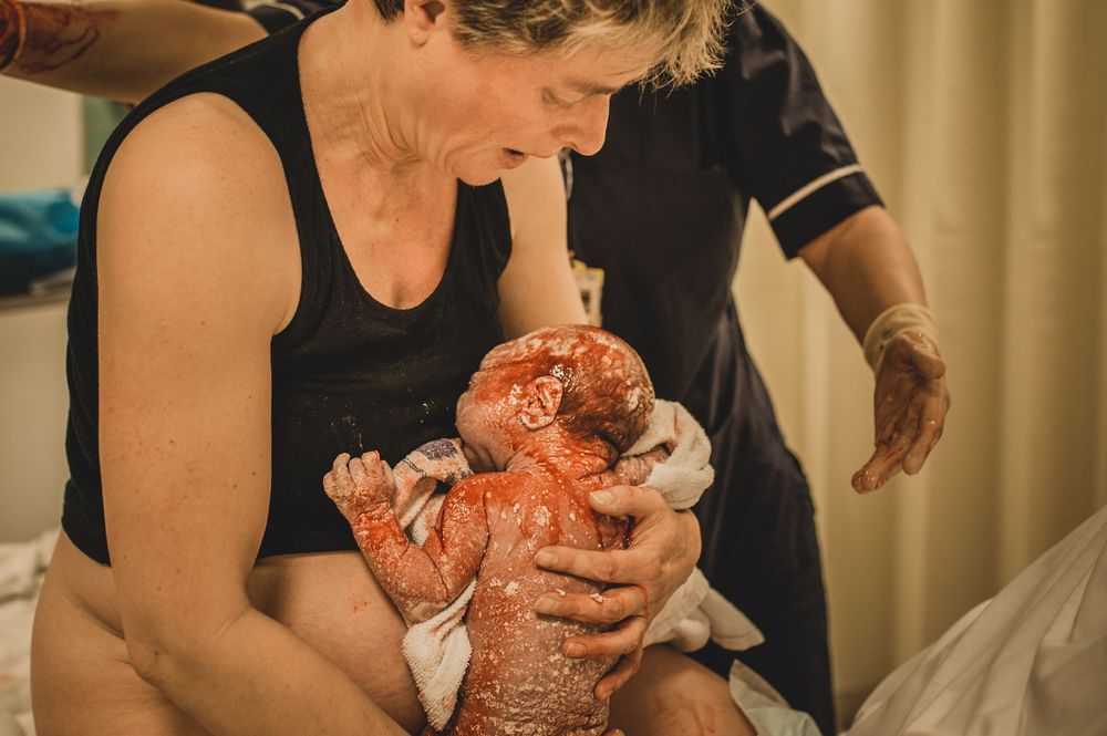 A mother holds her newborn baby covered in vernix immediately after birth, with a midwife assisting nearby.