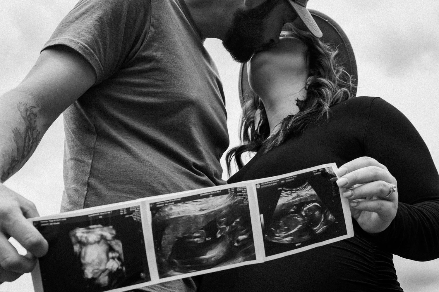 A series of ultrasound photos being held and displayed in sequence against a dark background.