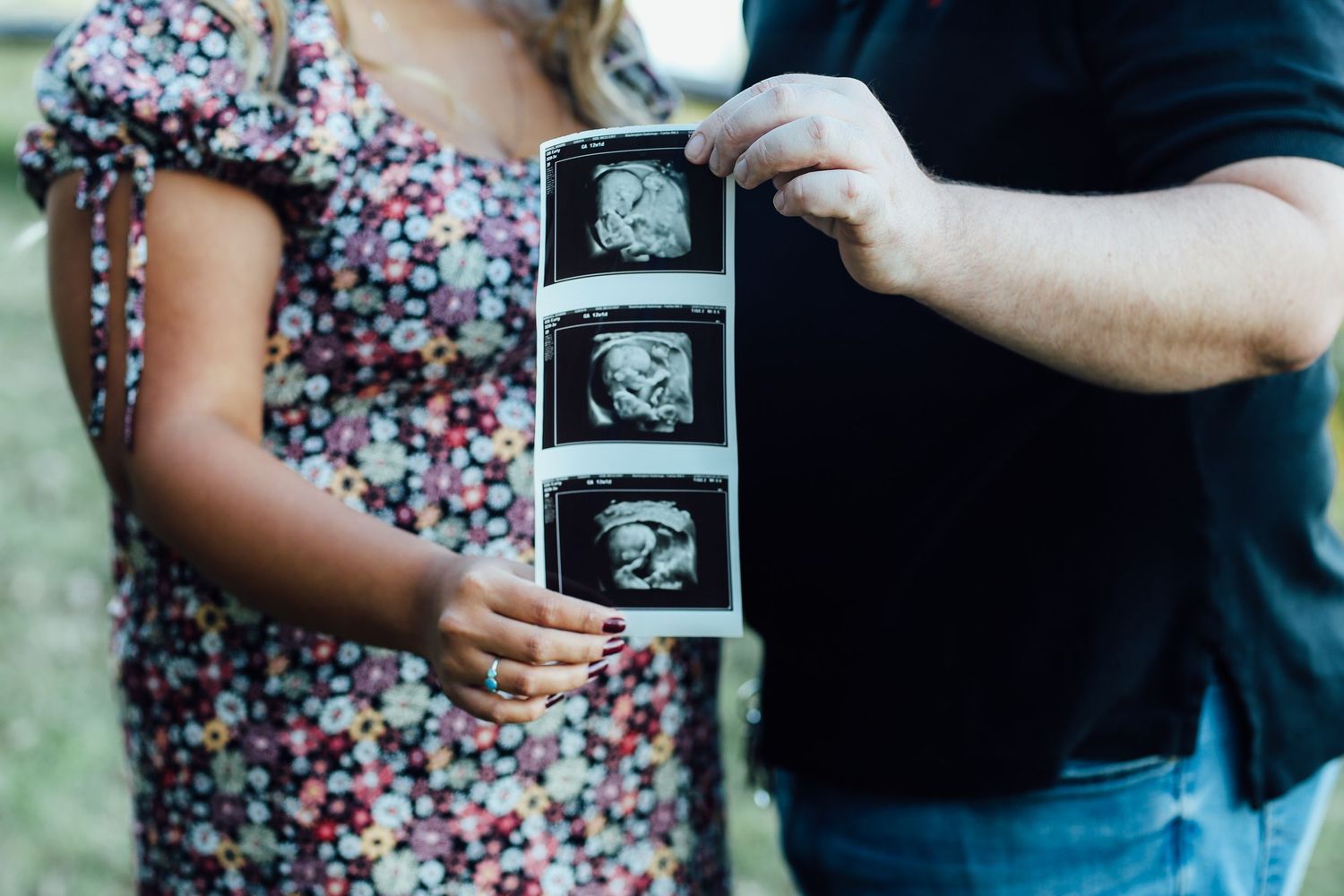 A couple holds up an ultrasound photo while sharing a tender moment outdoors in a natural setting.