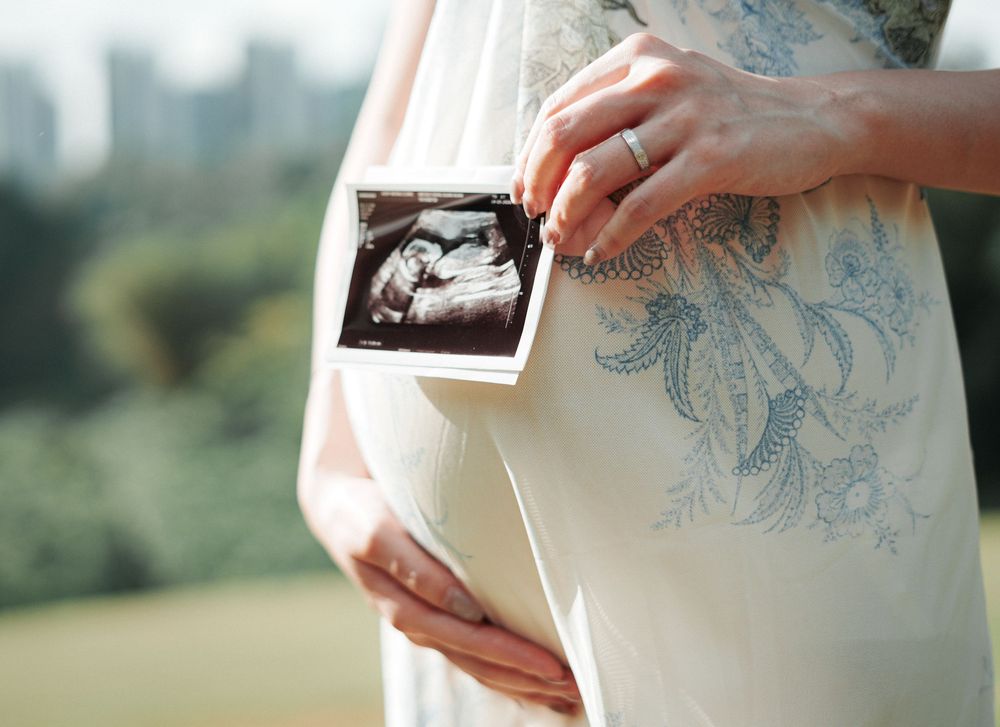 Pregnant woman in floral dress holding ultrasound photo against her baby bump outdoors.