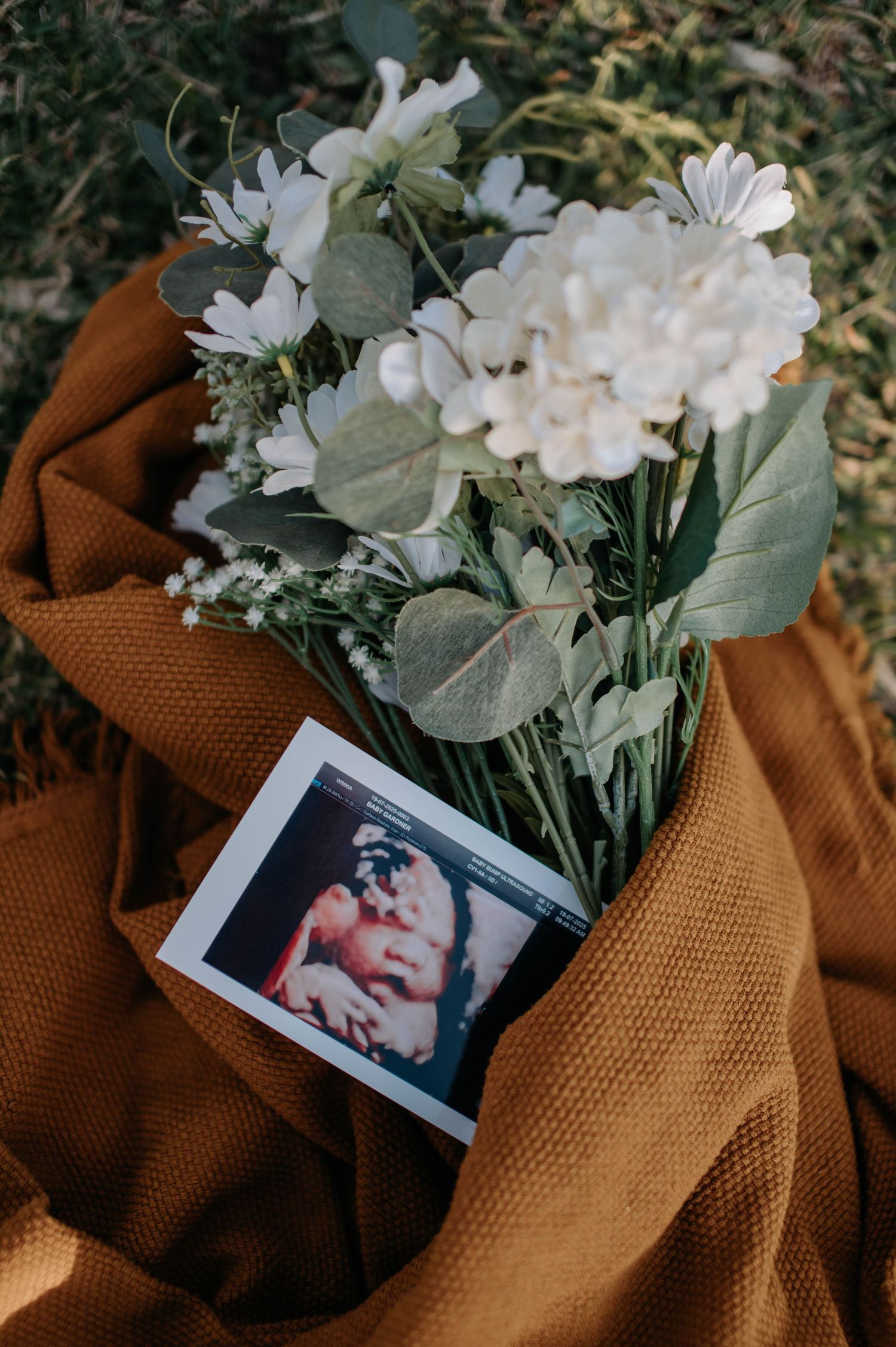 Ultrasound photo and white hydrangea bouquet with eucalyptus on a rustic orange knit blanket outdoors.