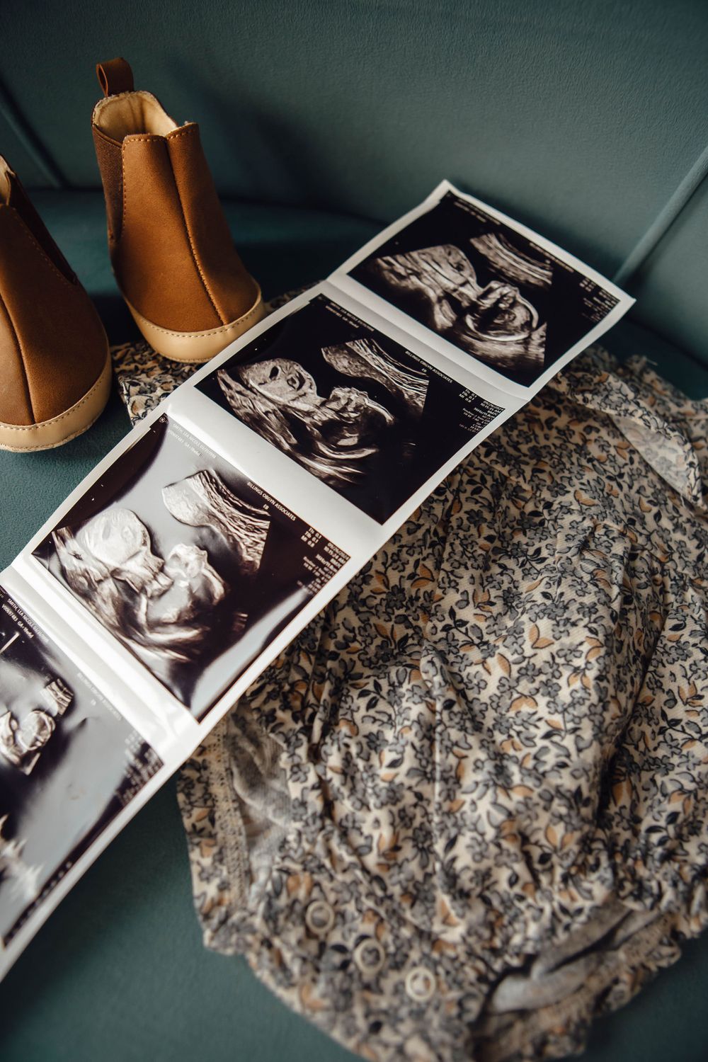 Ultrasound sonogram photos displayed next to brown boots and a gray textured fabric on teal surface.