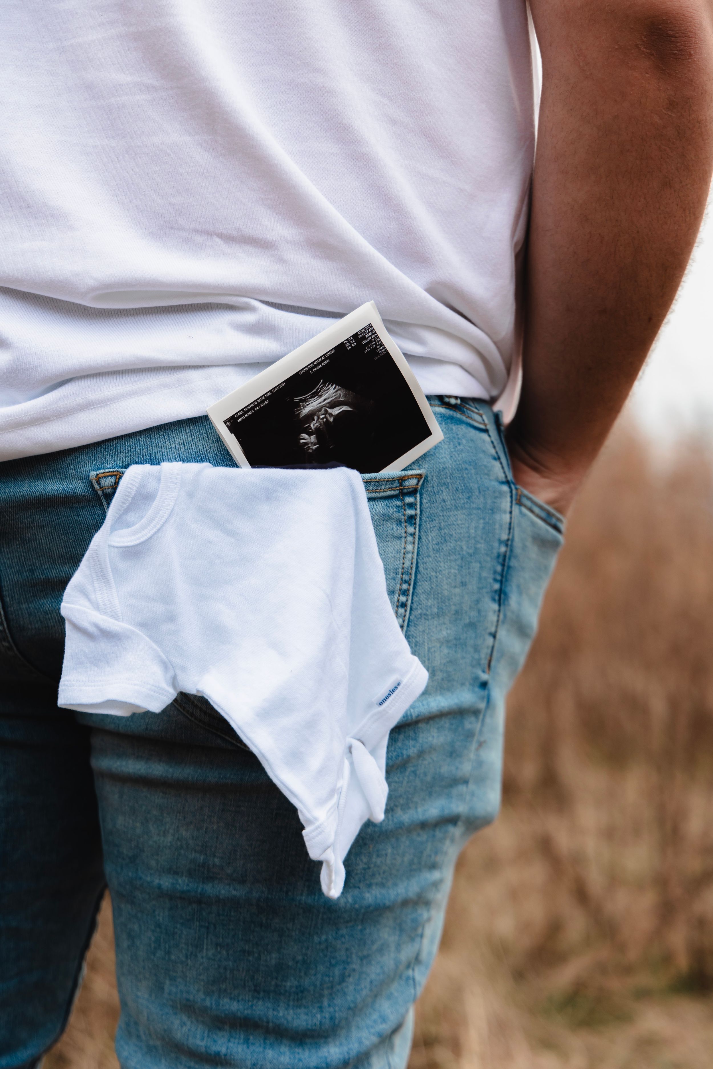 A sonogram ultrasound photo and white onesie displayed during a pregnancy announcement.