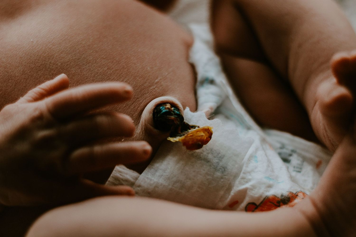 Close-up of a newborn baby's umbilical cord clamp on a diaper, capturing an intimate postpartum moment.