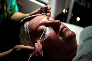 Close-up of beauty treatment with tweezers and facial care in progress.