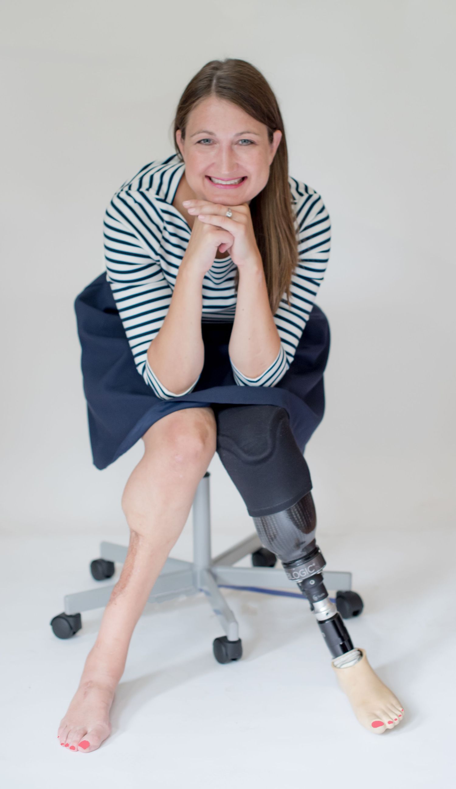 Ted Talk speaker Lindsey Roy in striped shirt sitting on office chair showing prosthetic leg.