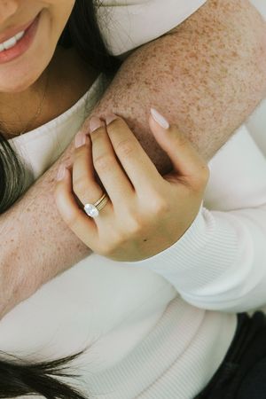 Close-up of a woman's hand wearing a diamond engagement ring and gold band, resting on a man's freckled arm.