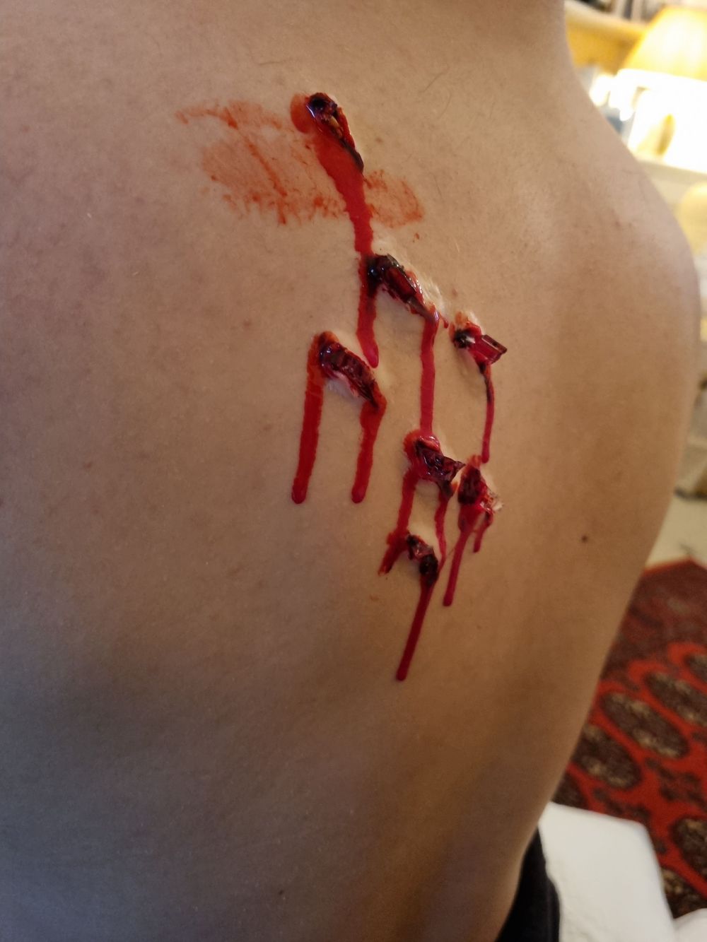 Glass fragments embedded in victims back