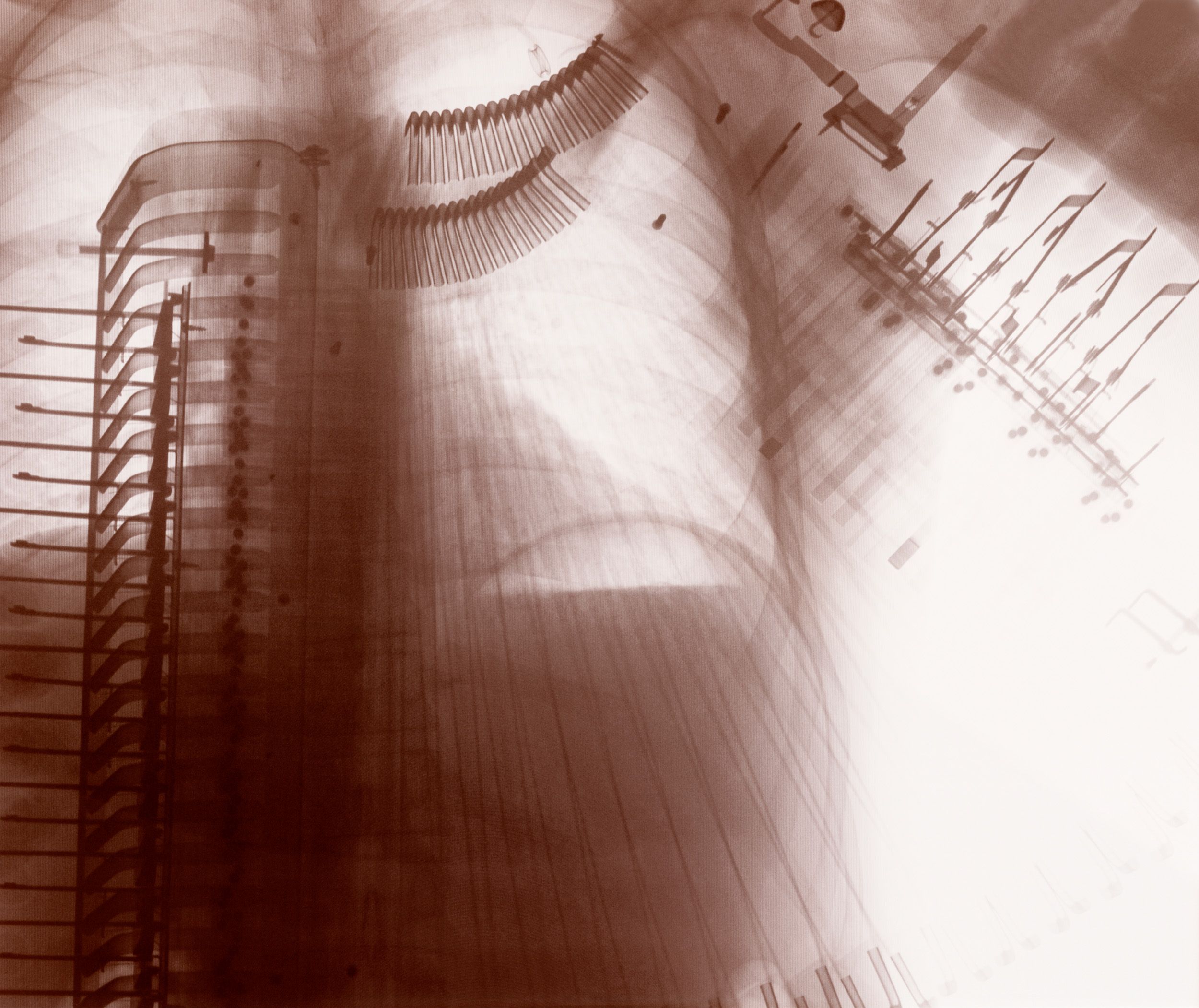 Collection of x-ray images showing anatomical structures in sepia tones.