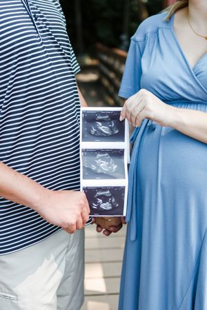 A couple in blue and striped outfits share ultrasound photos while standing together outdoors.