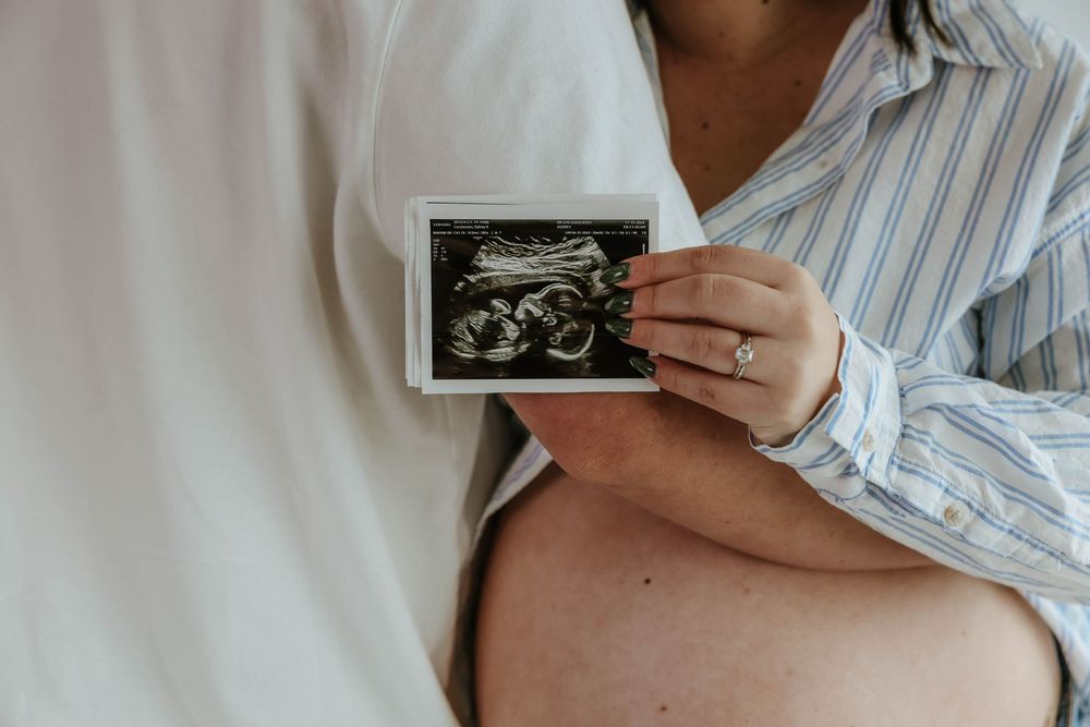 Someone holds a black and white ultrasound image against their pregnant belly while wearing a striped button-down shirt.