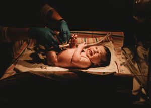 Birth photography