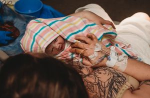 Birth photography