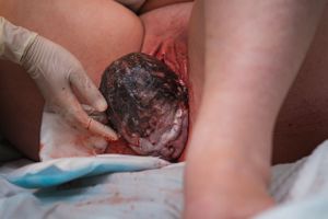 Birth photography