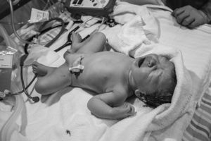 Birth photography