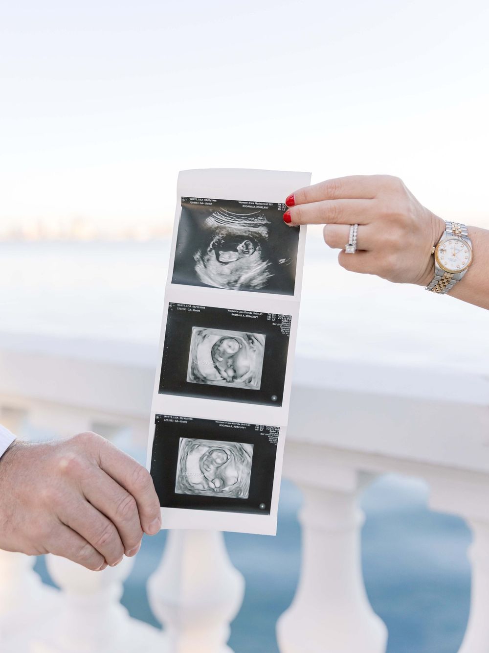 Hands holding ultrasound photos against white balcony railing with water view.