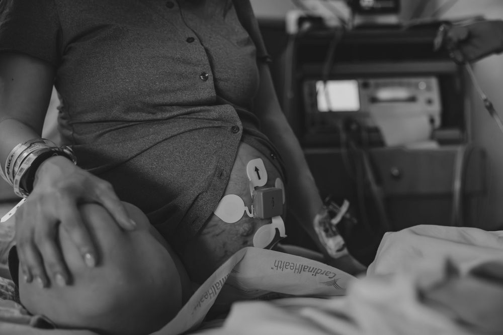 Close-up view of medical monitoring equipment attached to a patient's torso during treatment.