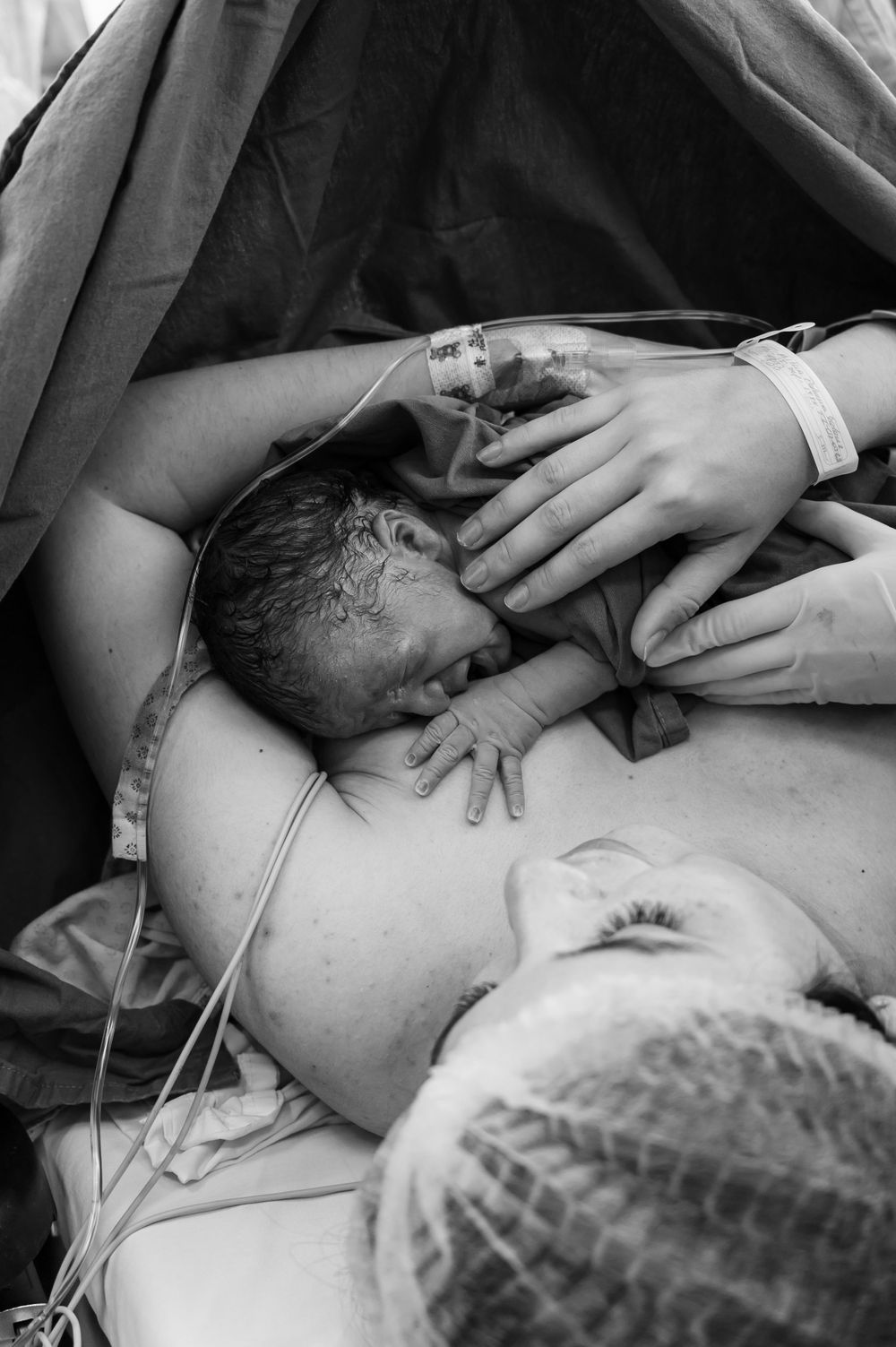 Newborn baby being examined by medical staff immediately after cesarean delivery.