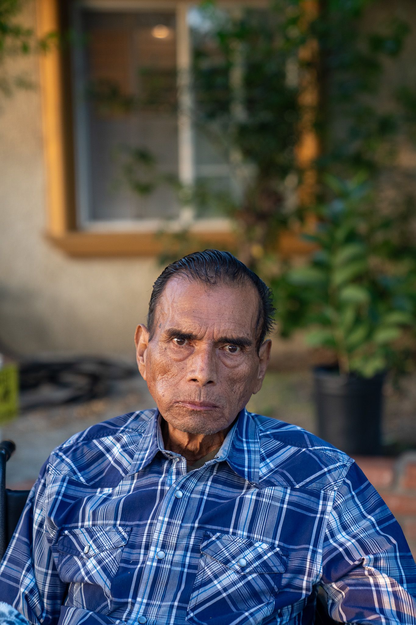 Person wearing a blue plaid shirt sitting outdoors with sunlit trees in the background.