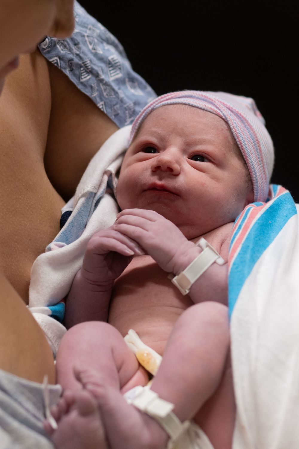 Close-up of a newborn baby with hospital identification bands and monitoring equipment.
