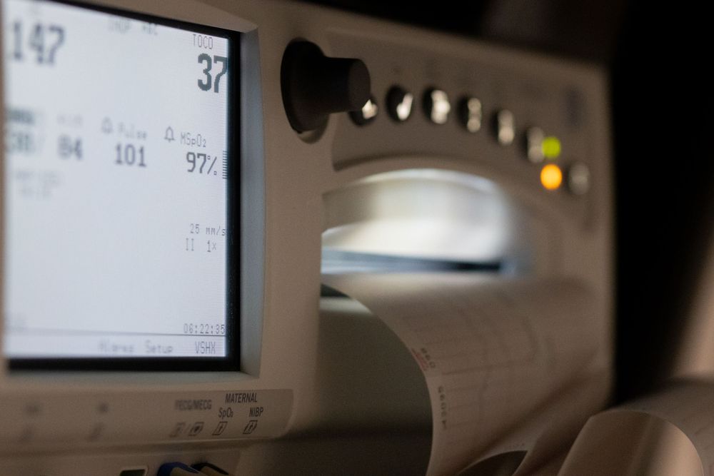 Digital medical monitor display showing vital signs in a dark room.
