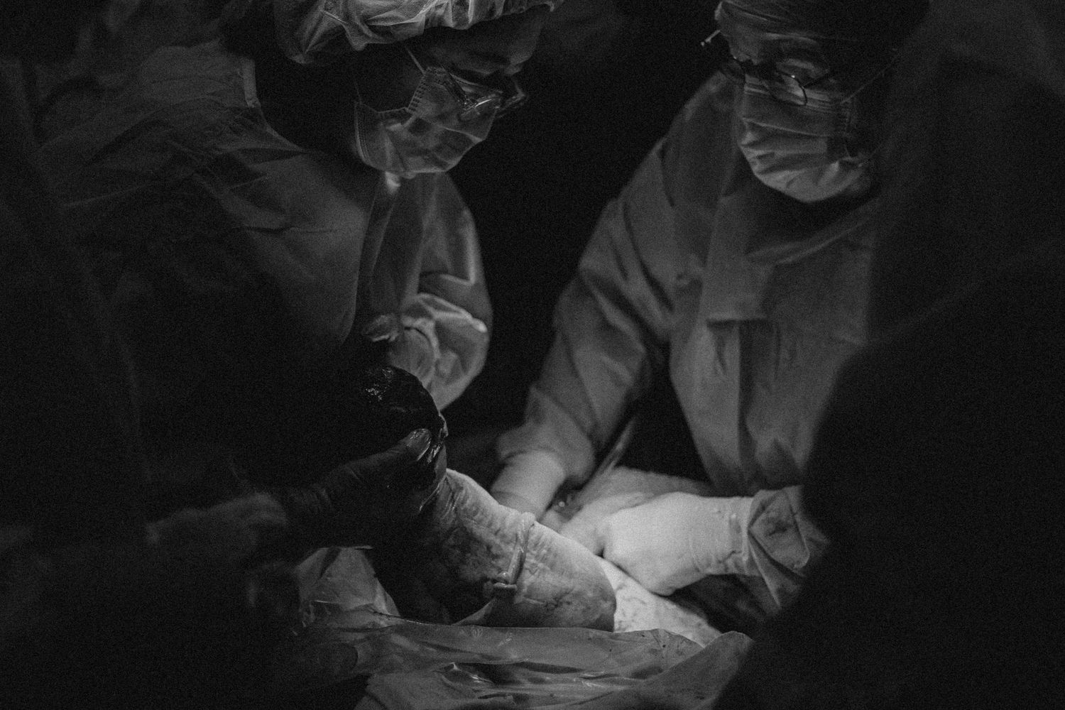 Medical professionals perform surgical procedure in operating room under bright focused lighting.
