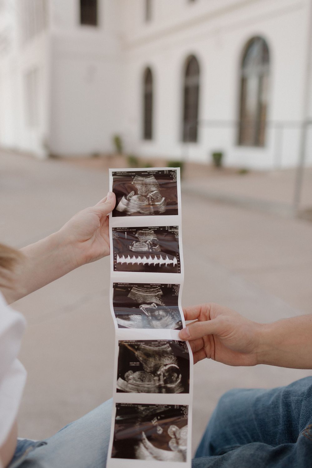Hands holding a strip of black and white ultrasound images in front of a white building.