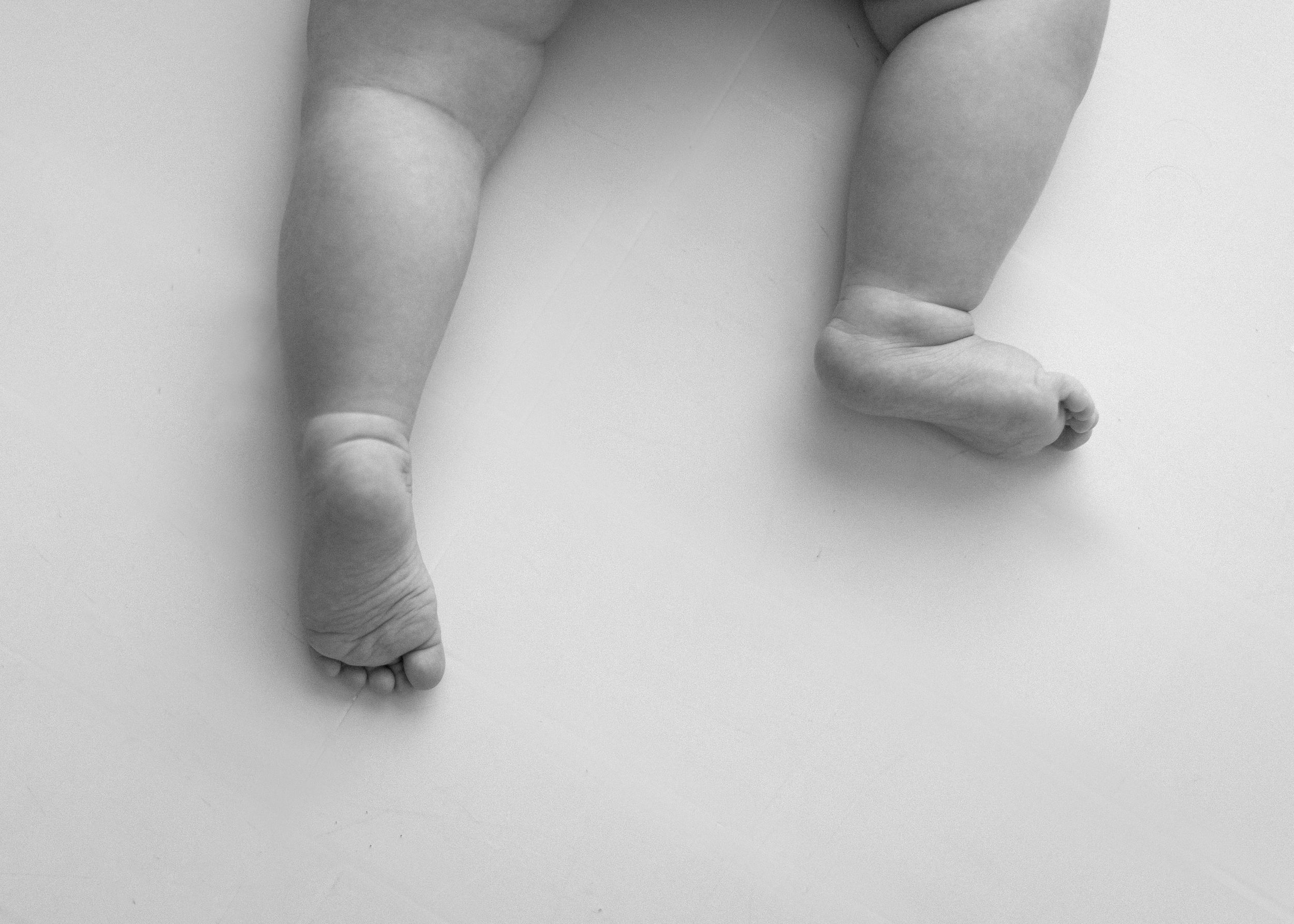 Close-up black and white photograph of tiny baby feet against a white background.