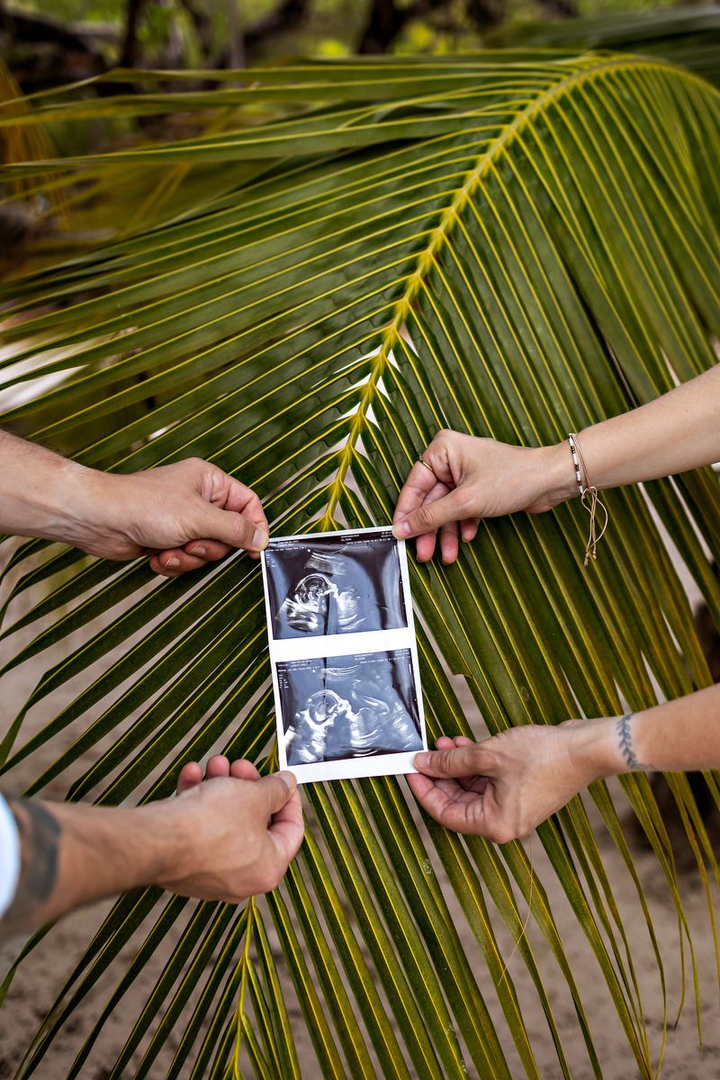 Two hands holding ultrasound photos in front of a tropical palm leaf, announcing a pregnancy.