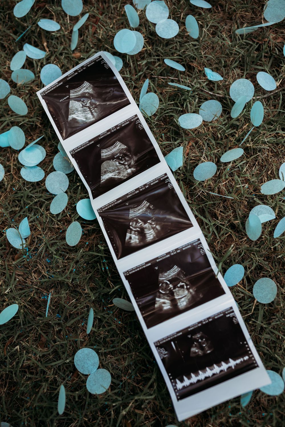 Ultrasound sonogram photos arranged on grass with scattered light blue confetti decorations.