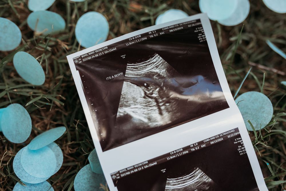 Ultrasound photos surrounded by scattered blue confetti on the ground during a gender reveal.