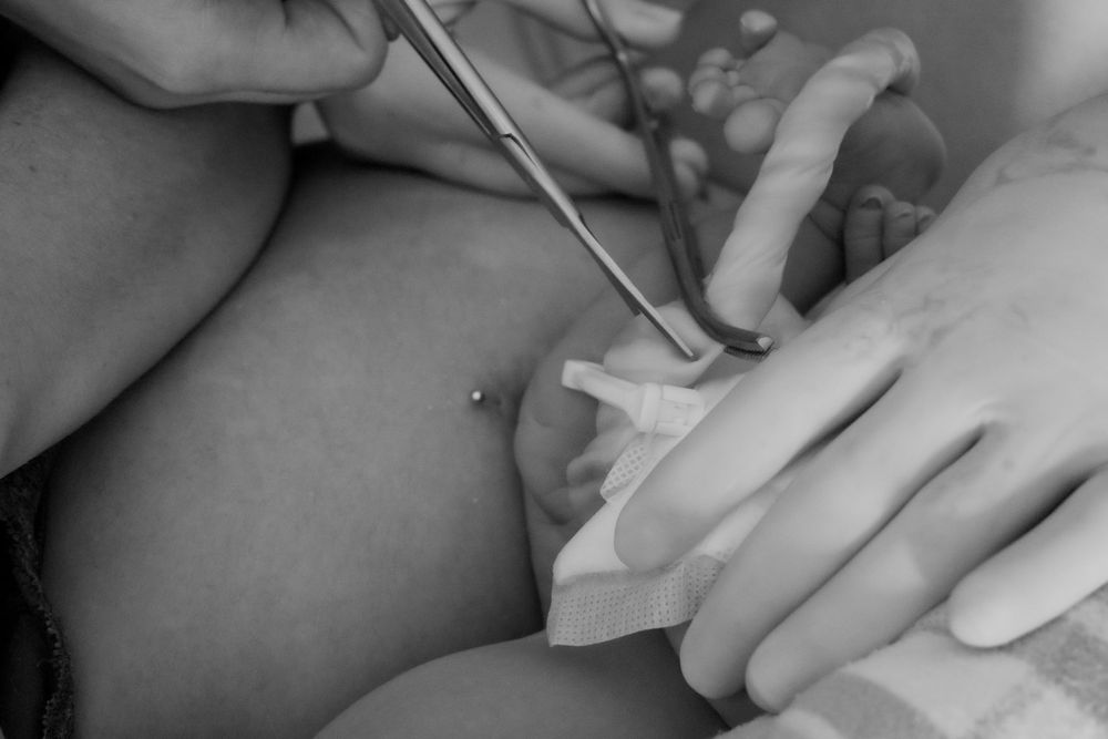 Black and white photo showing father cutting the umbilical cord with gloves and medical instruments during a central coast birth session.