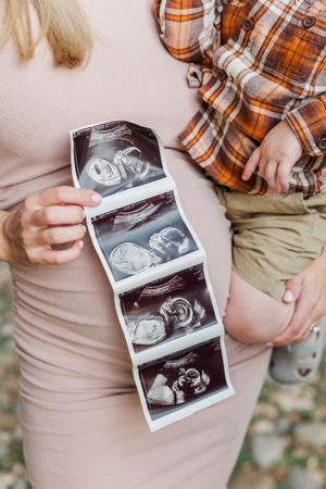 Pregnancy announcement featuring ultrasound photos and plaid shirt details.