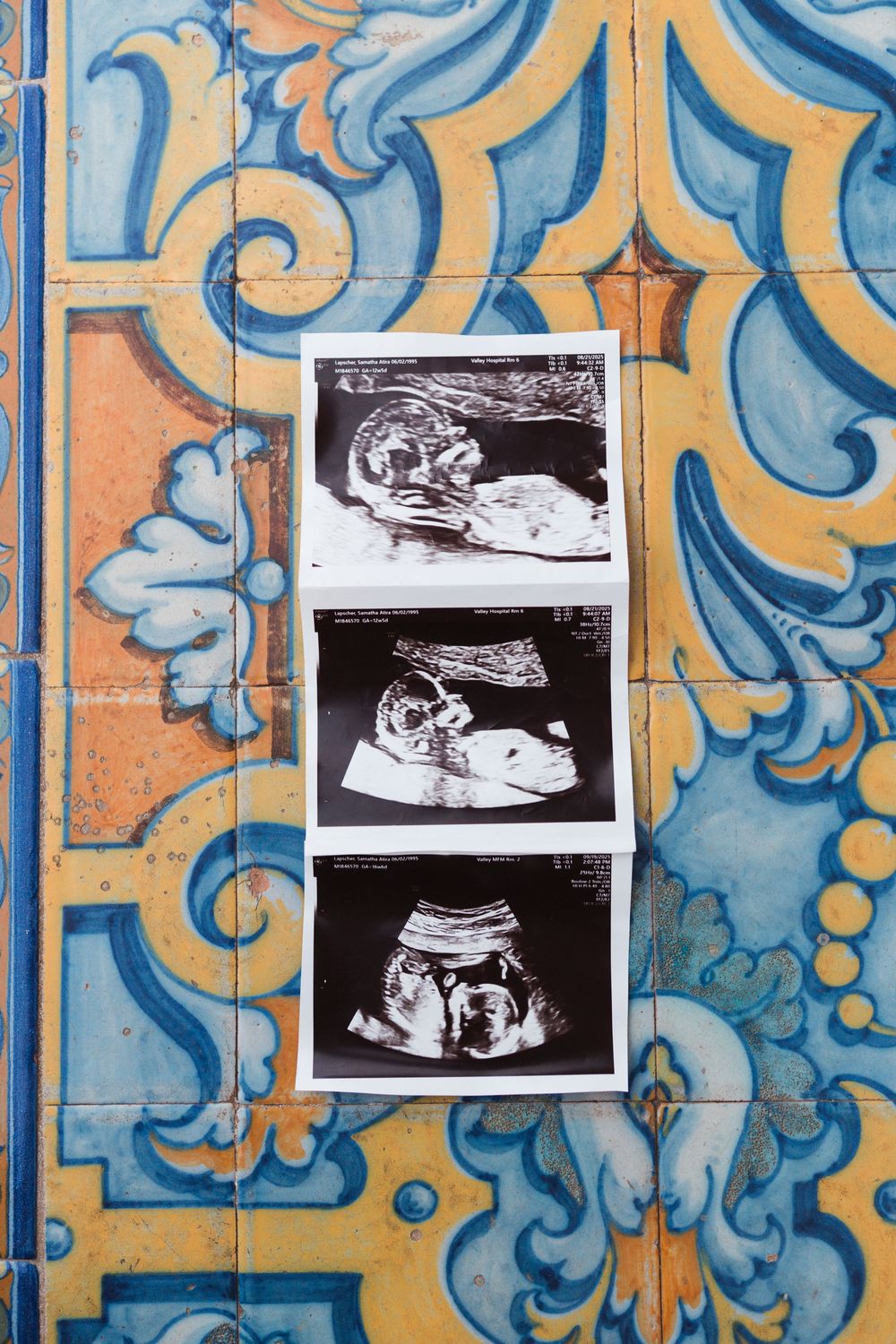 Ultrasound photos displayed against decorative blue and orange tiled wall background.