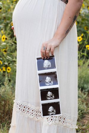 A hand holds ultrasound photos against a white lace dress with sunflowers in the background.