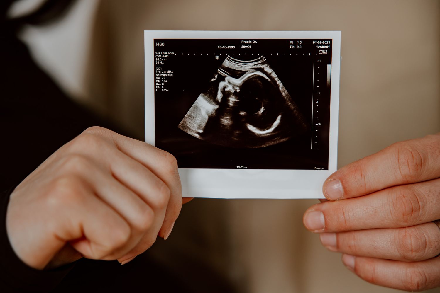 babybauch shooting hamburg, babybauch shooting kleid, babybauch shooting ideen, babybauch fotoshooting, babybauch bilder